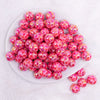 top view of a pile of 16mm Red Lips AB Print on Hot Pink bubblegum bead