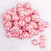 top view of a pile of 20mm Red Lips AB Print on White bubblegum bead